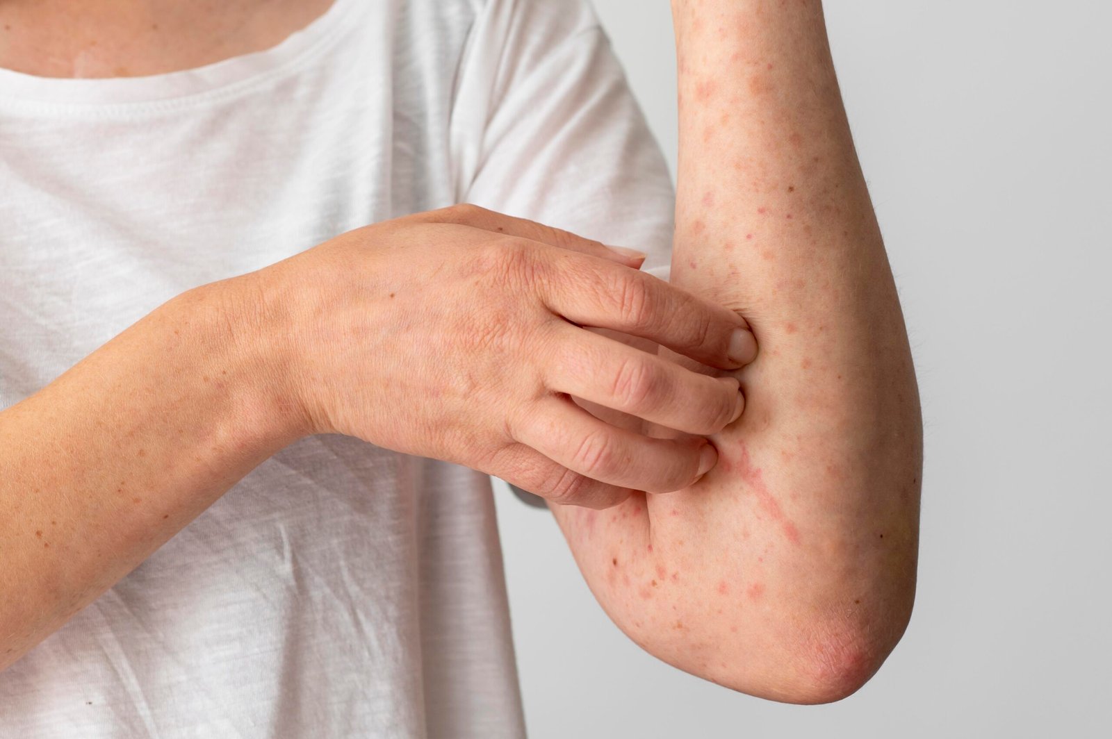 skin-allergy-reaction-person-s-arm