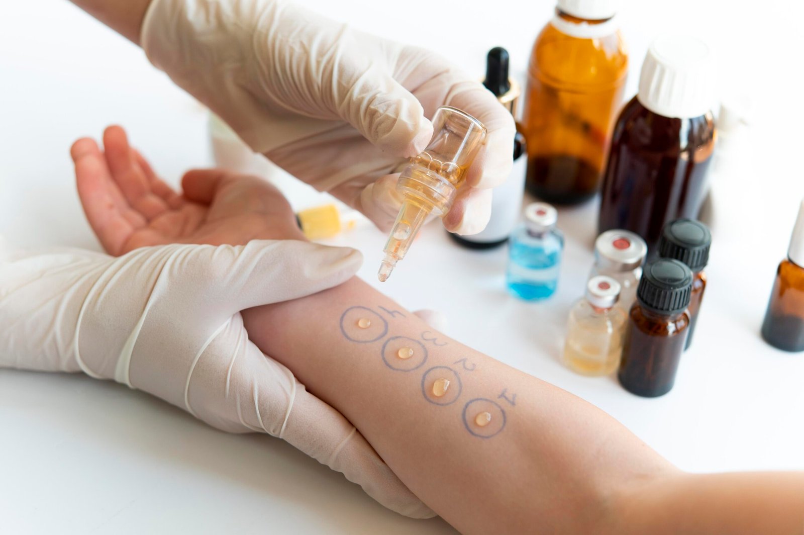 skin-allergy-reaction-test-person-s-arm